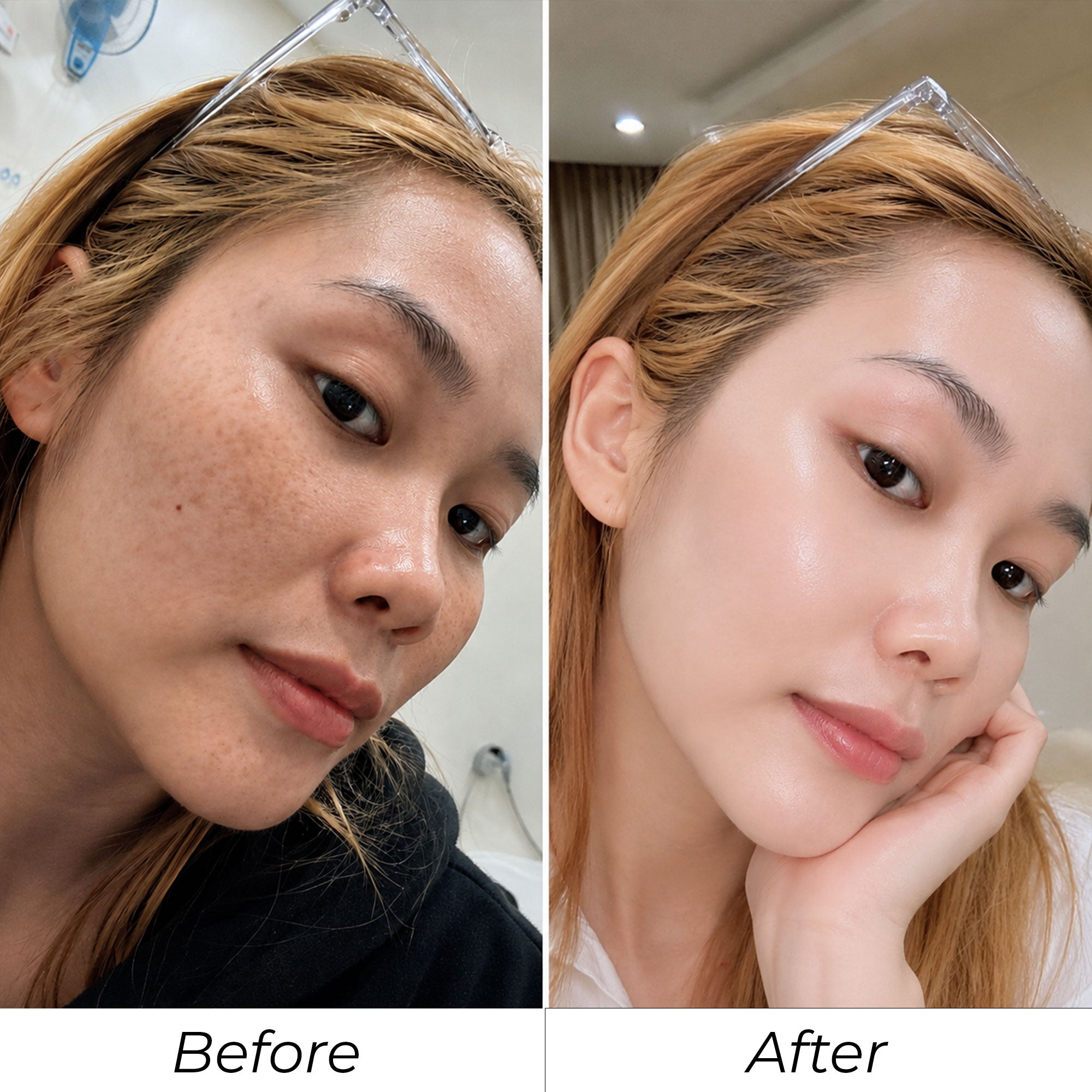 Phản hồi khách hàng SHYLY trước và sau số 2