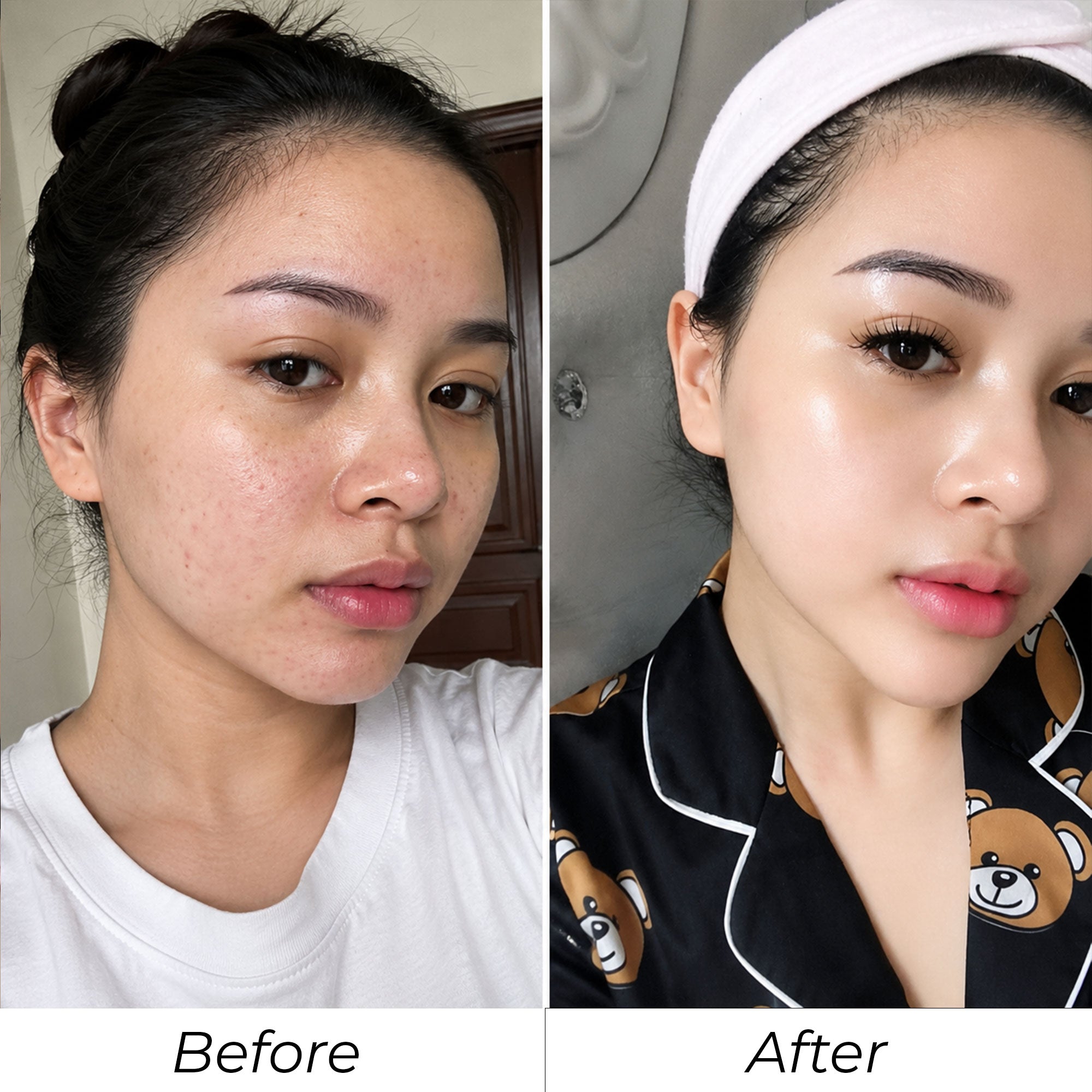 Phản hồi khách hàng SHYLY trước và sau số 3