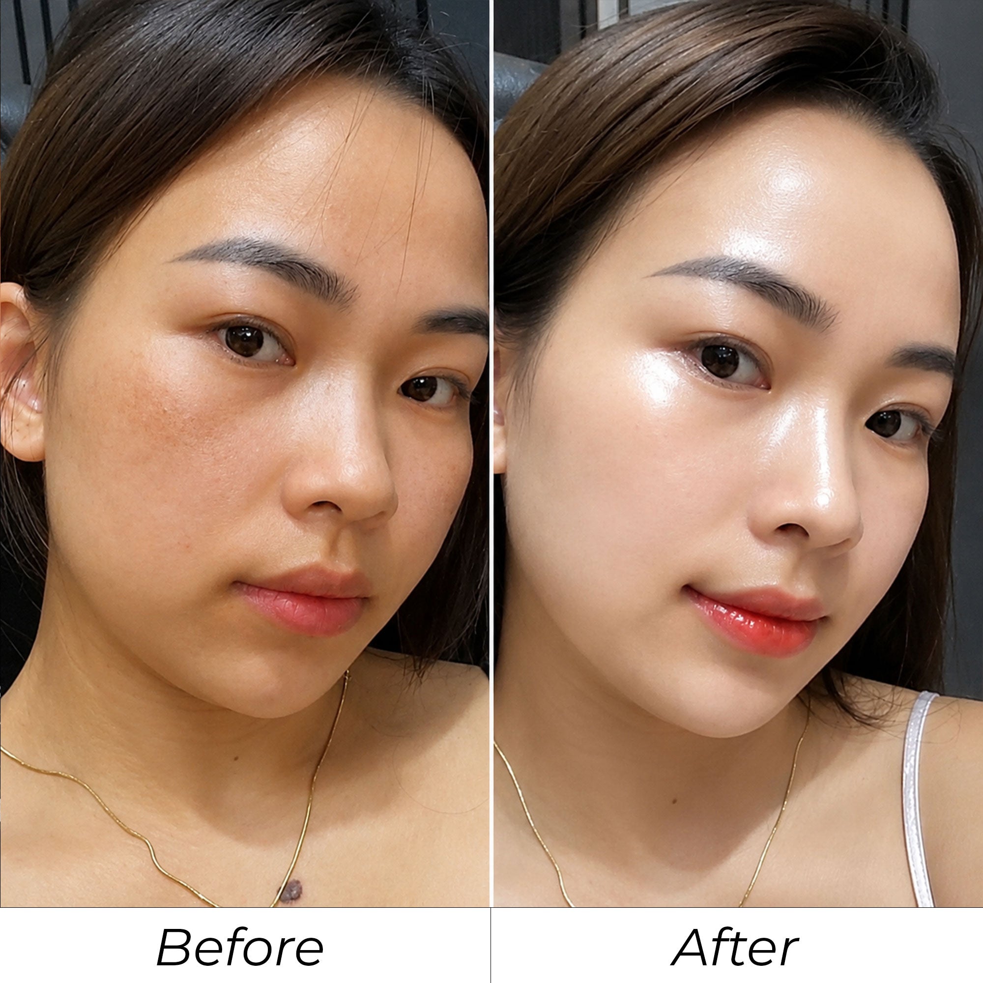 Phản hồi khách hàng SHYLY trước và sau số 4