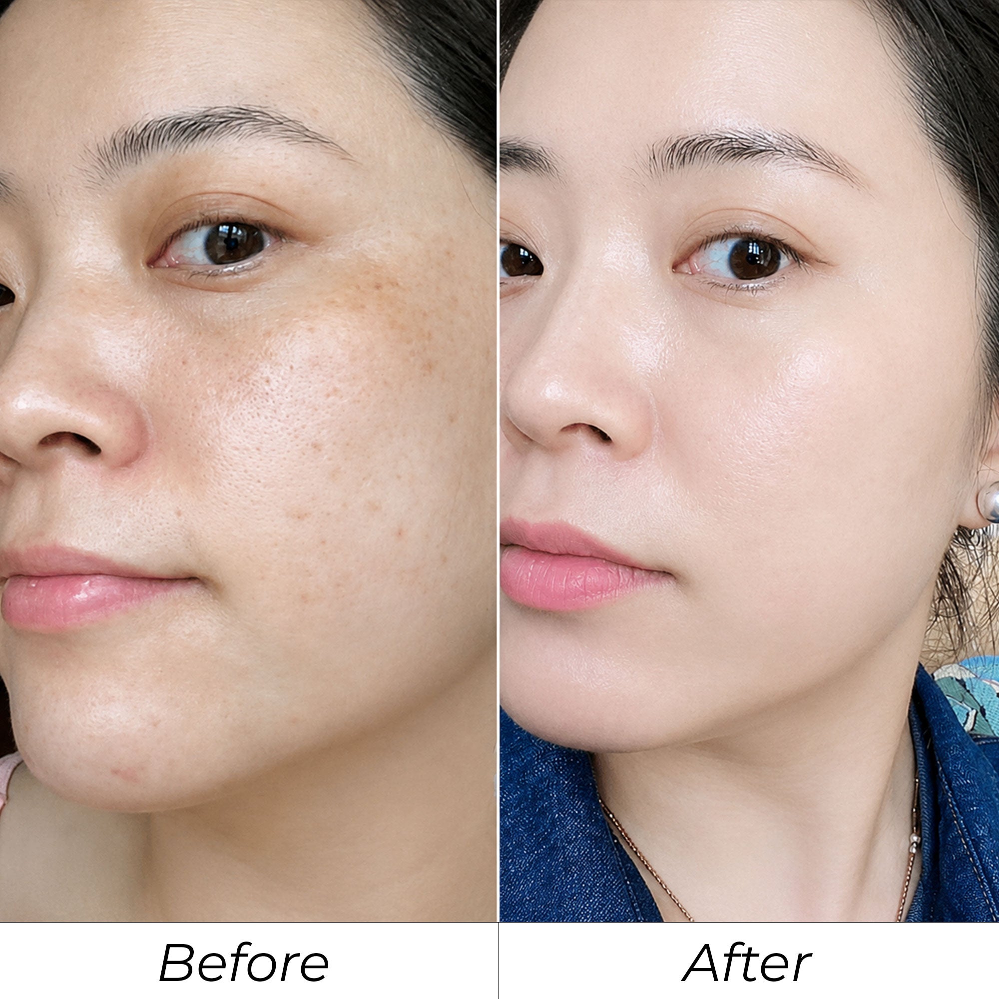 Phản hồi khách hàng SHYLY trước và sau số 5